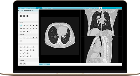 诊断级别影像